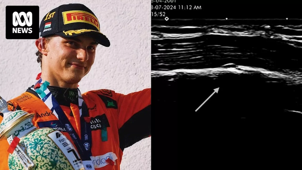 Oscar Piastri appears to have won Hungarian Grand Prix with a fractured rib after posting image of X-ray