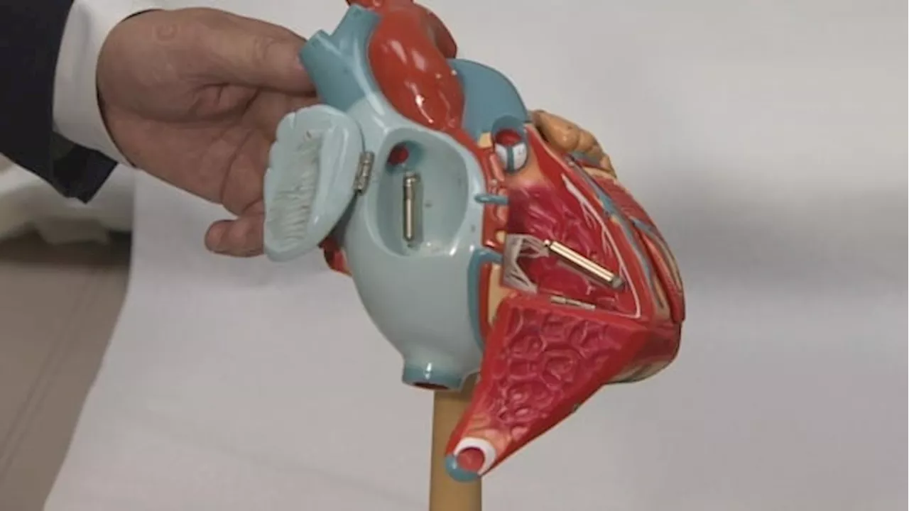 Calgary among 2 Canadian cities offering advanced pacemaker to cardiac patients