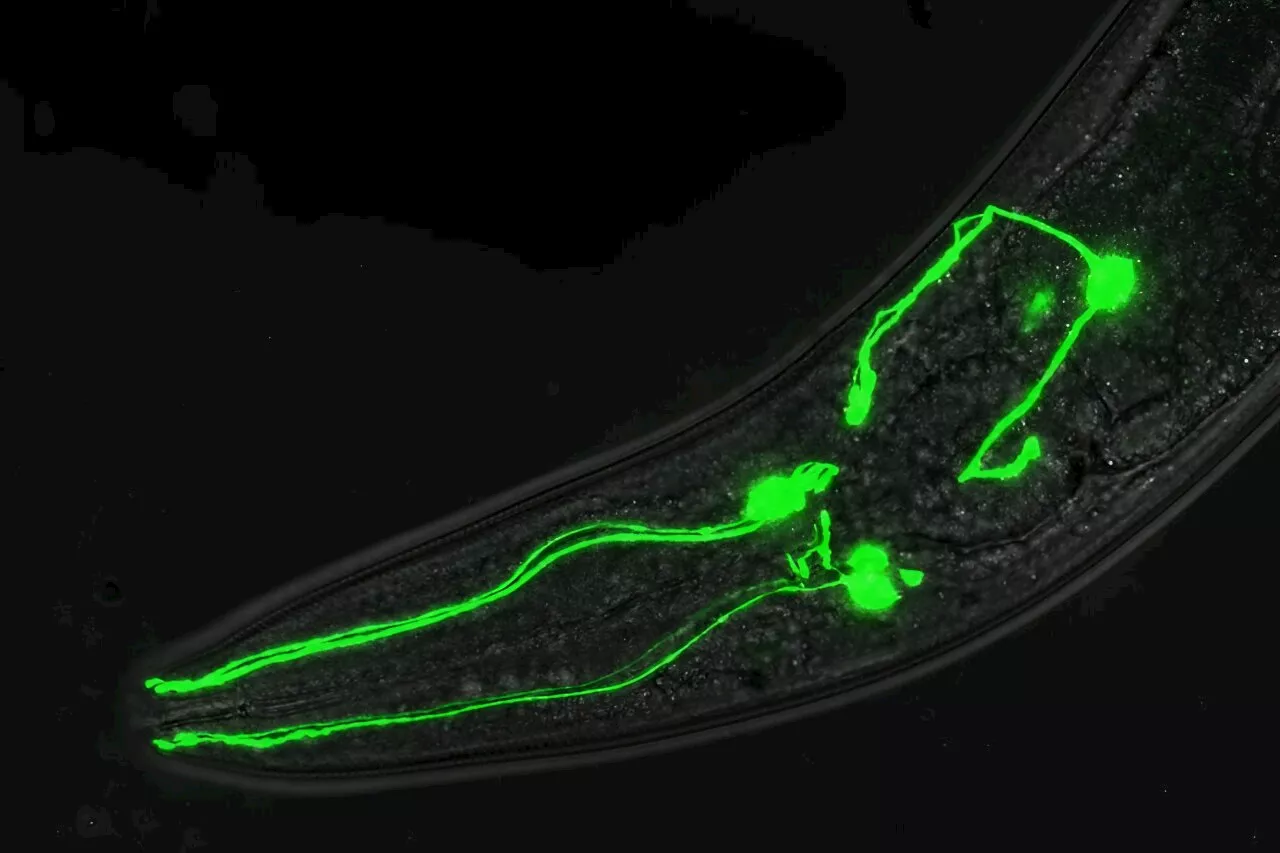 Taking a 'one in a million' shot to tackle dopamine-linked brain disorders