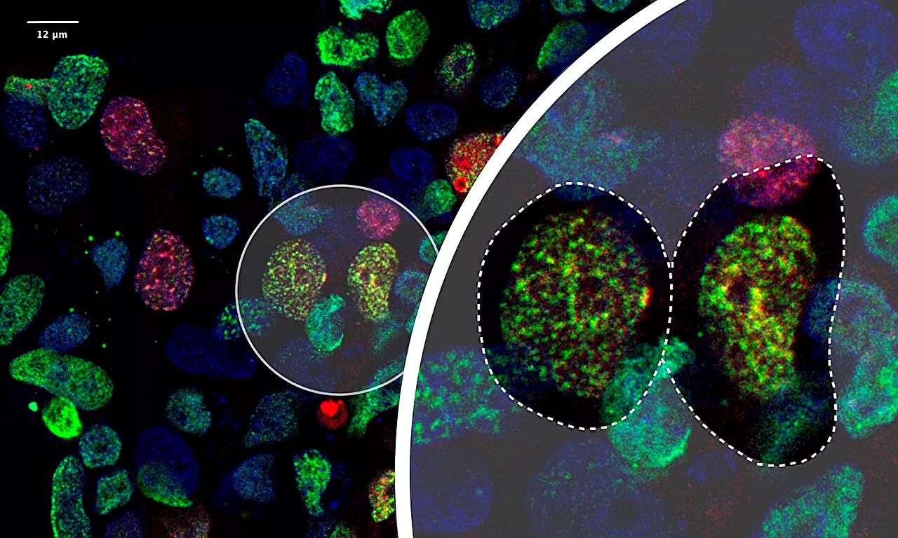 Developing a simple, cost-effective method to identify the targets of a crucial protein-modifying enzyme