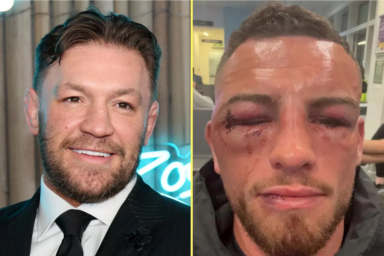 Conor McGregor hails brutal bare-knuckle boxing bout that left new champion barely recognisable...