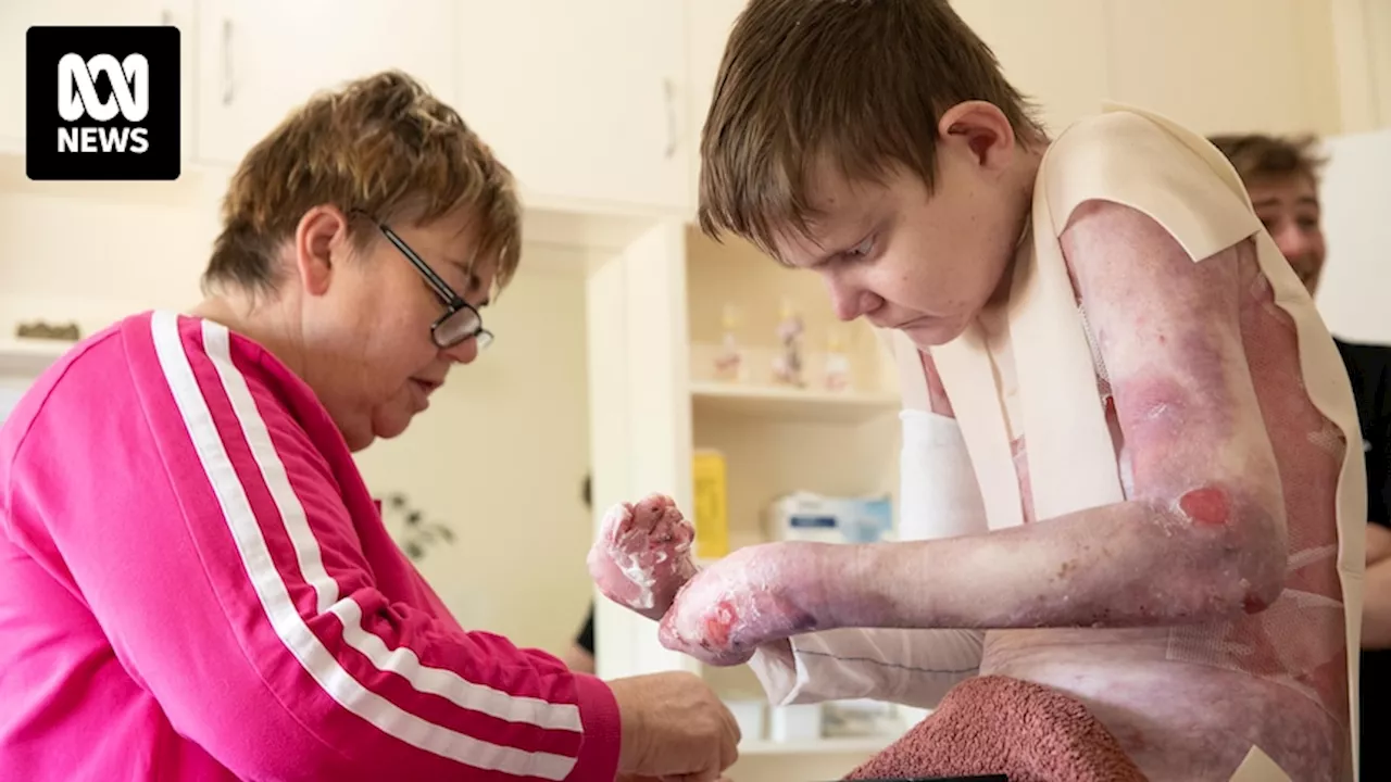 Epidermolysis bullosa is a rare genetic disease that affects only 7,000 Australians — and John Hutchins is one of them