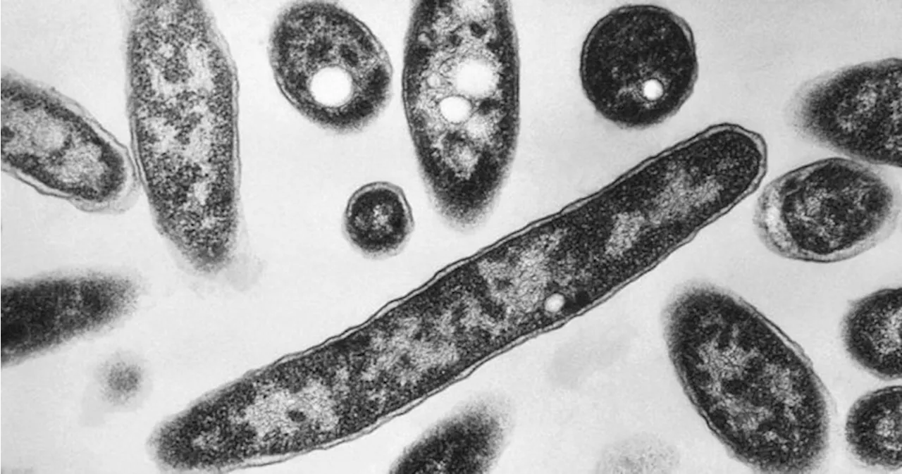 Public health still looking for source of legionnaires’ disease outbreak in London, Ont.