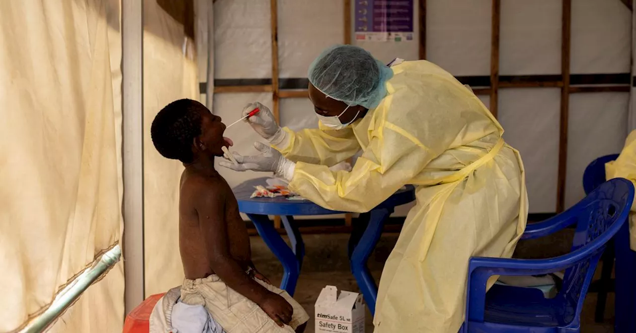 Mpox: les nouveaux variants apparus en Afrique sont-ils une menace pour le reste du monde ?