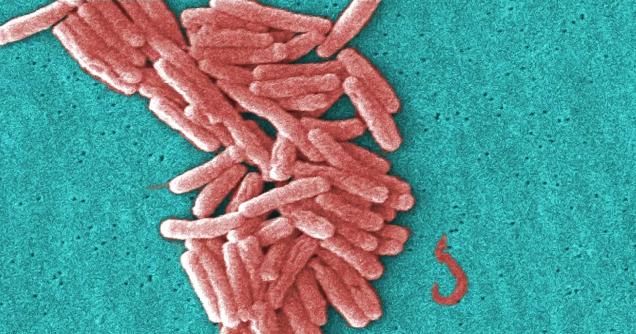 5 people diagnosed with Legionnaires' disease in New Hampshire after possible exposure from cooling tower