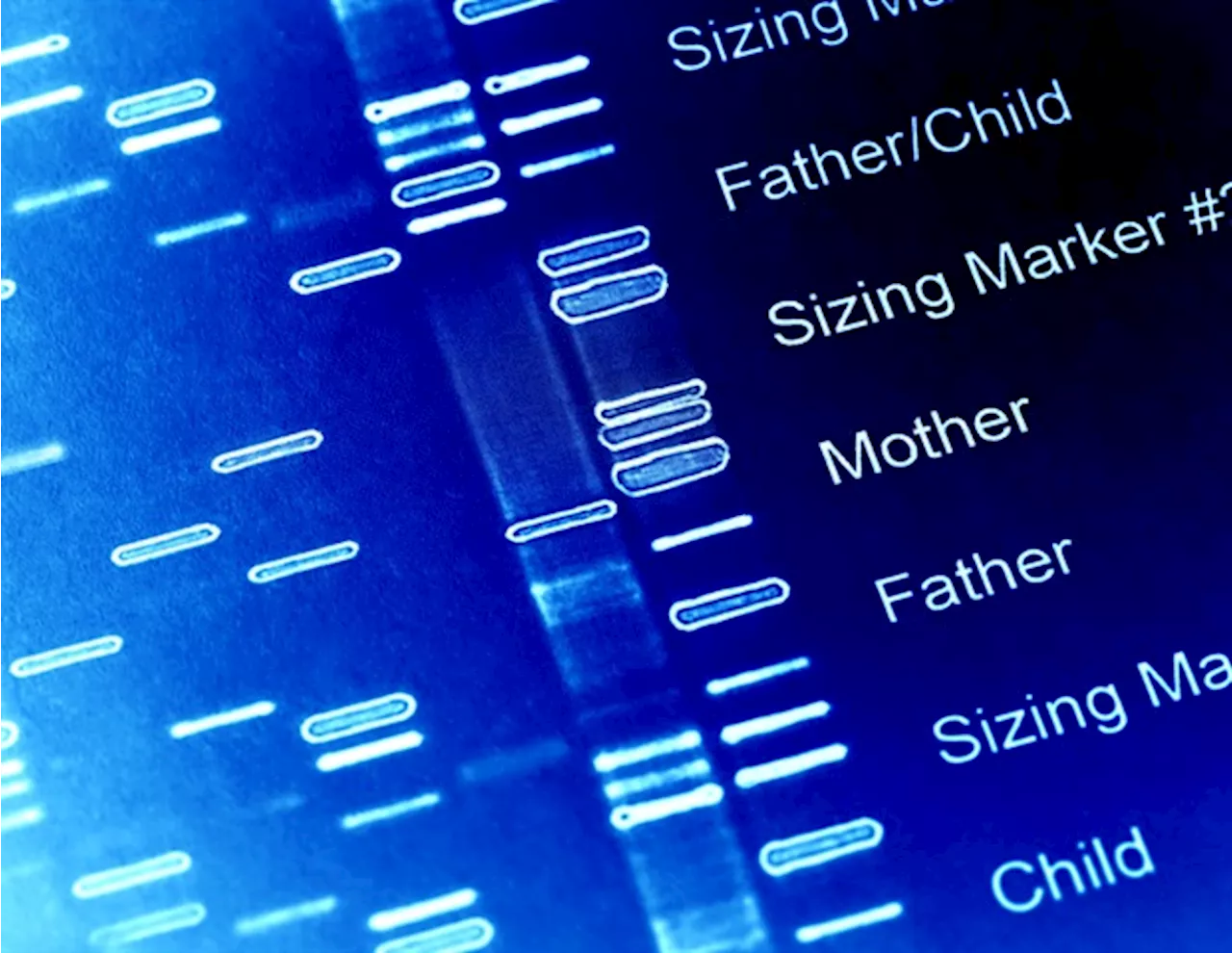 Generative AI in genetics: Effective but needs monitoring for consistency