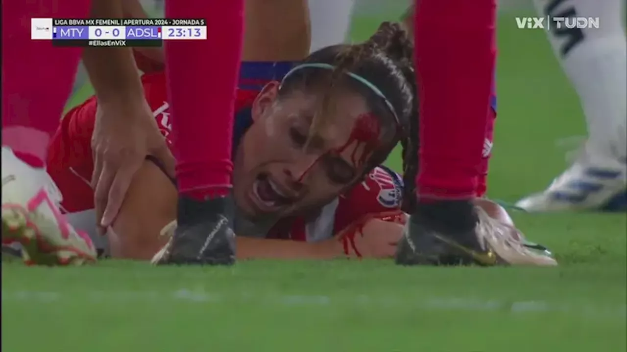 Luciana García sufre aparatoso choque de cabezas en partido de Liga MX Femenil