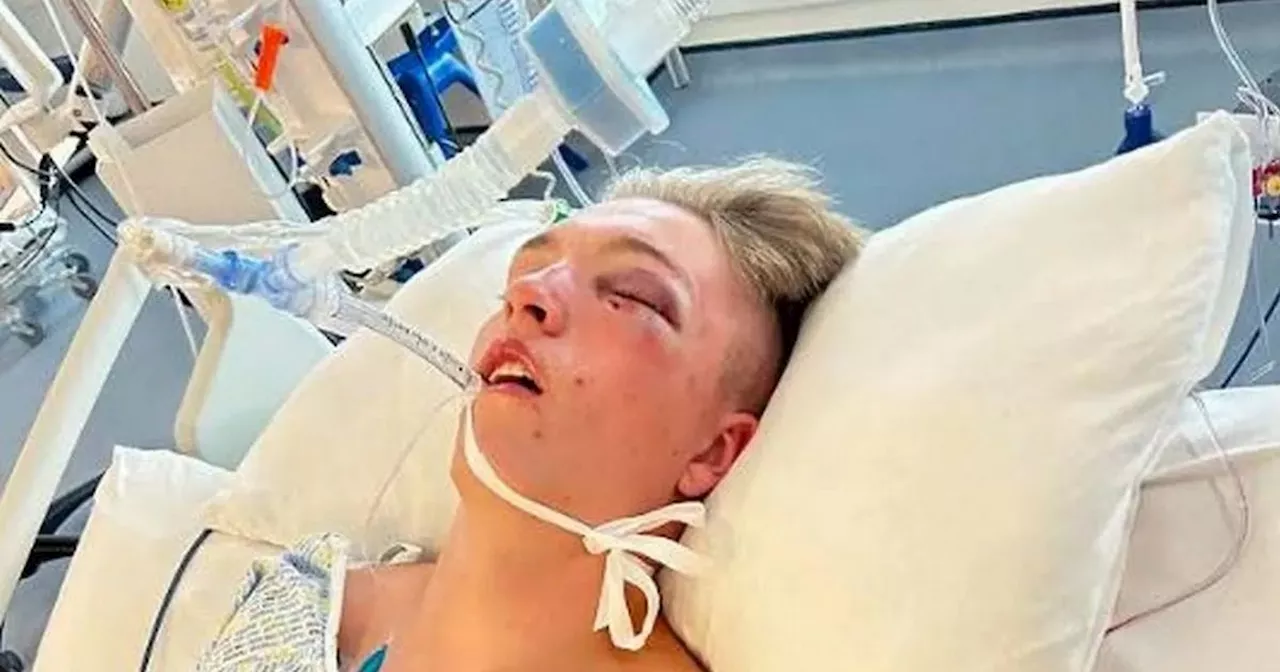 Man, 18, charged with attempted murder after TRNSMT attack left boy in coma