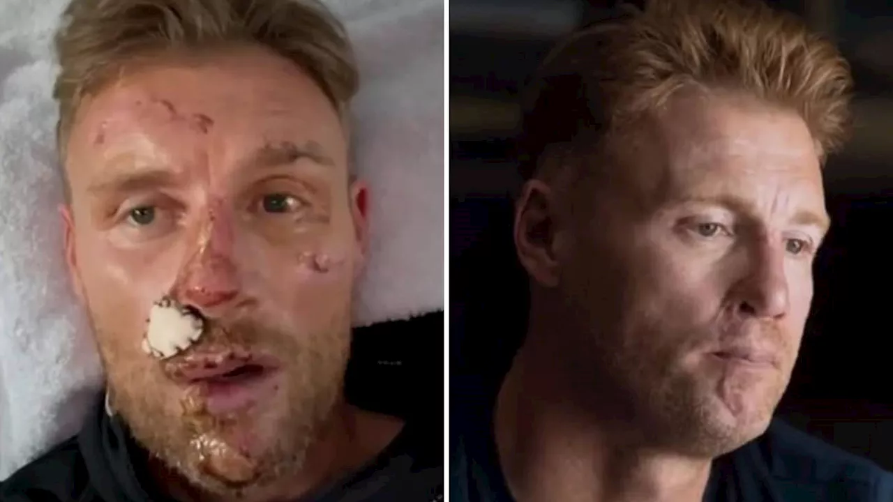 'I'm really struggling and I need help': Freddie Flintoff's Top Gear crash injuries revealed