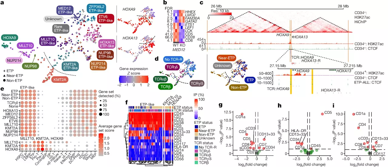 New research poised to transform approach to diagnosing and treating acute leukemia in children