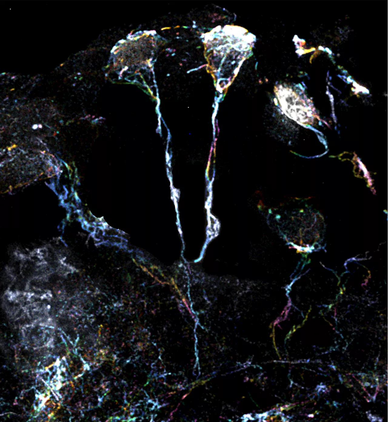 Scientists discover method to activate dormant stem cells in the brain