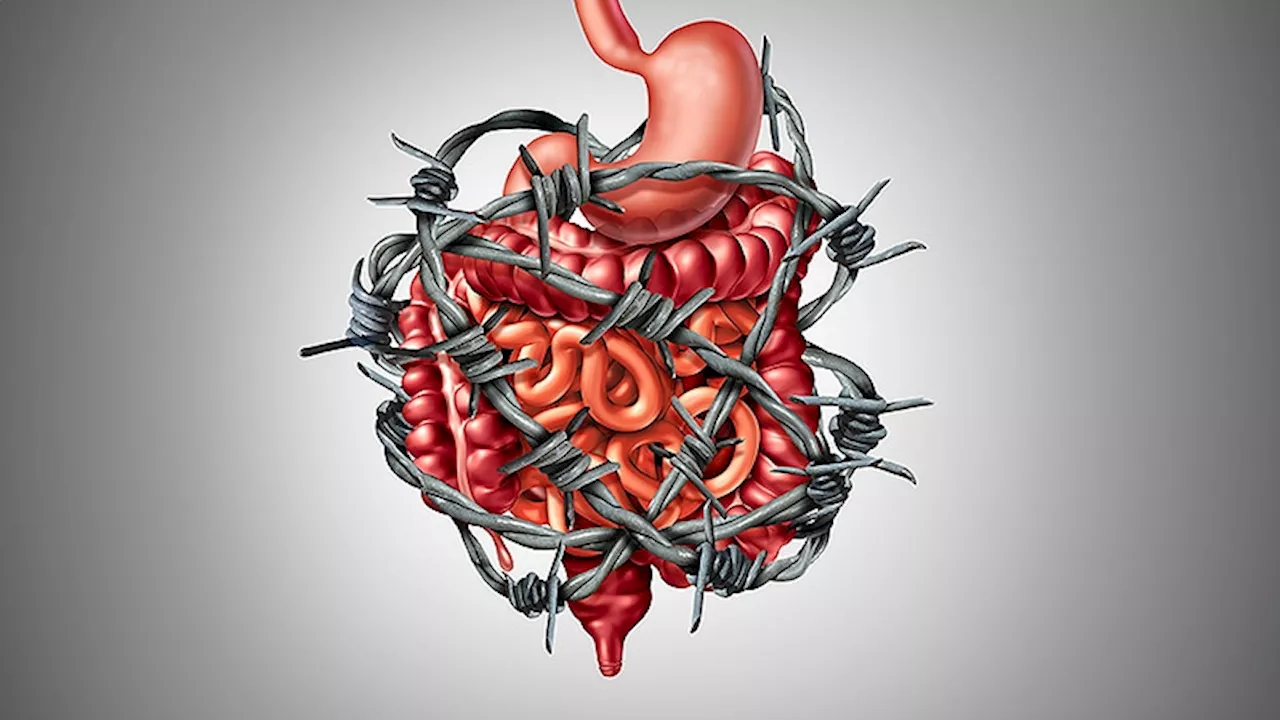 Half of Patients Show Prolonged IBS Post-Gastroenteritis