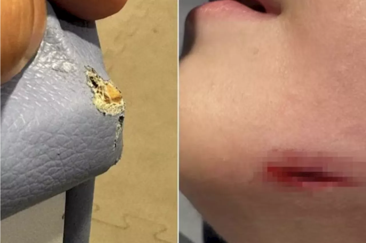 Boy, 4, needs stitches after fall in restaurant playroom