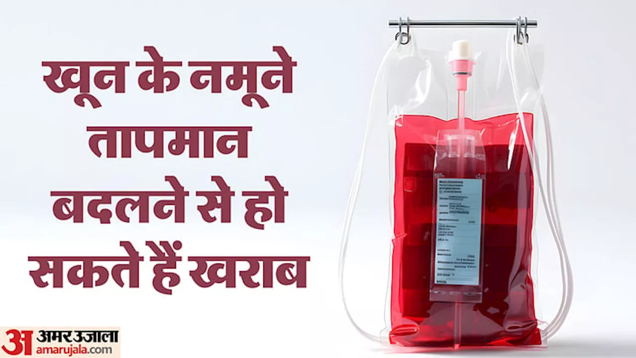 Blood Test: घर से लिए ब्लड सैंपल को इतने तापमान में रखें, वर्ना सैंपल हो सकता है खराब, रिपोर्ट हो सकती है गलत!