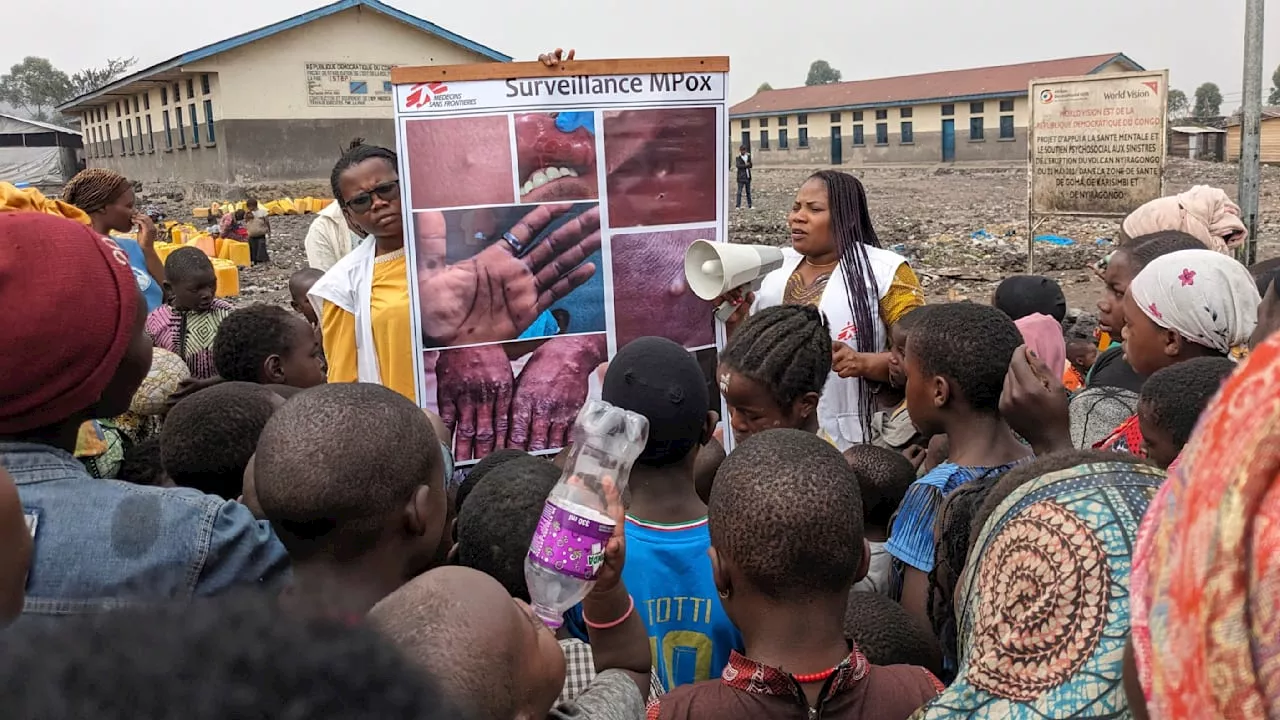 Mpox: Affenpocken! Das müssen Afrika-Urlauber wissen