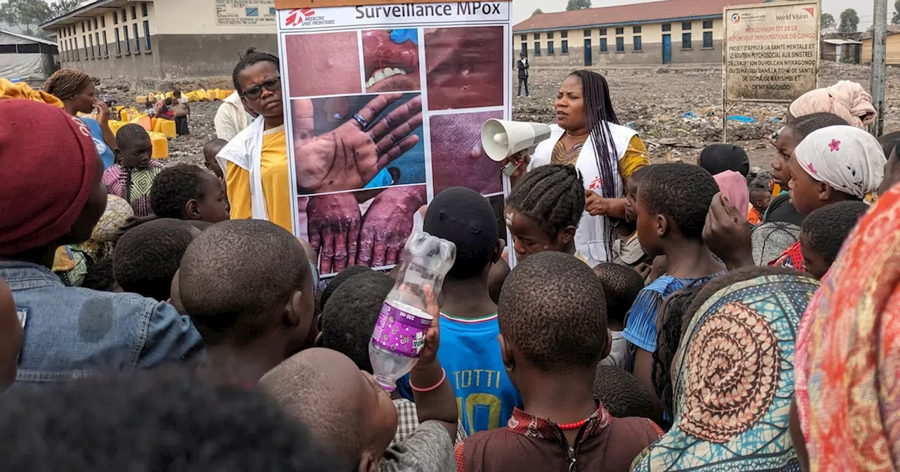 What is mpox and why has it been declared a global health emergency?