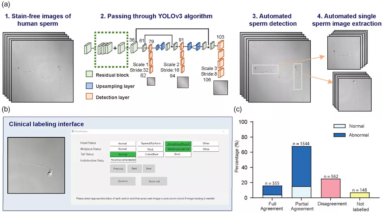 AI sperm checker enhances IVF success