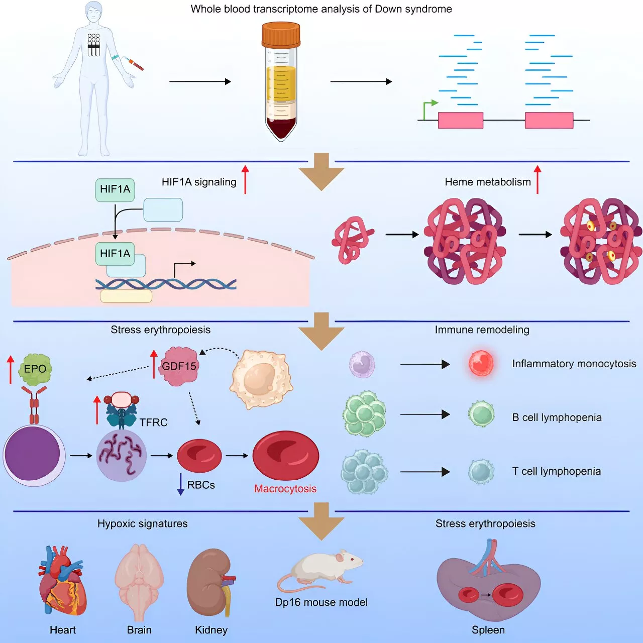 New research discovers differences in oxygen physiology in people with Down syndrome