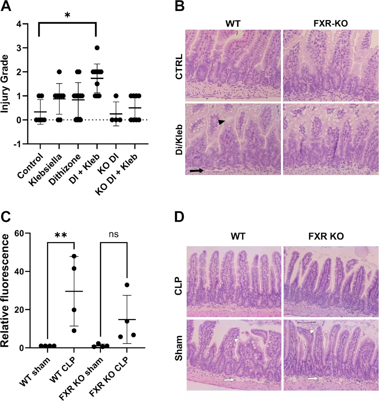 Removing bile acid receptor in gut blocks intestinal inflammation, study shows