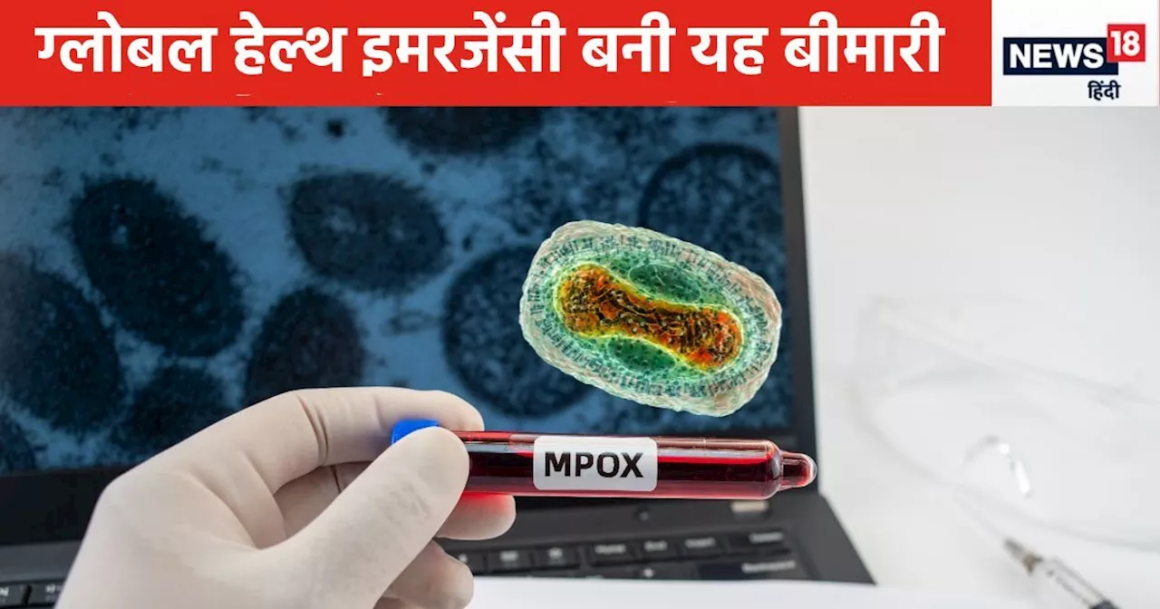 WHO ने इस बीमारी को पब्लिक हेल्थ इमरजेंसी घोषित किया, जानिए कितना खतरनाक है Mpox, हमें डरने की कितनी जरूरत