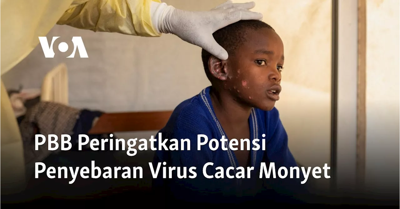 PBB Peringatkan Potensi Penyebaran Virus Cacar Monyet