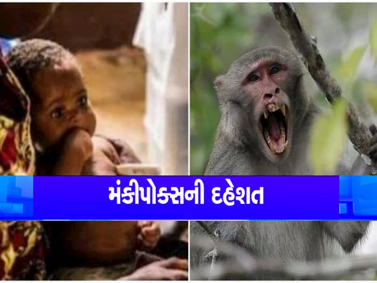 શરીરમાં આ લક્ષણો દેખાય તો ચેતી જજો, આખી દુનિયા માટે ઈમરજન્સી બન્યો આ ઘાતક વાયરસ, વિશ્વભરમાં આ રોગે હાહાકાર મચાવ્યો