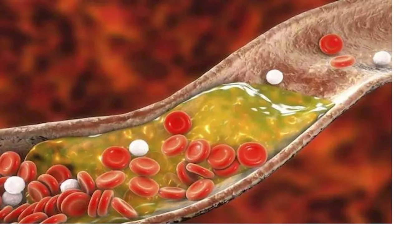 Cholesterol Myths: కొలెస్ట్రాల్ గురించి ప్రచారంలో ఉన్న 3 అవాస్తవాలు ఇవే