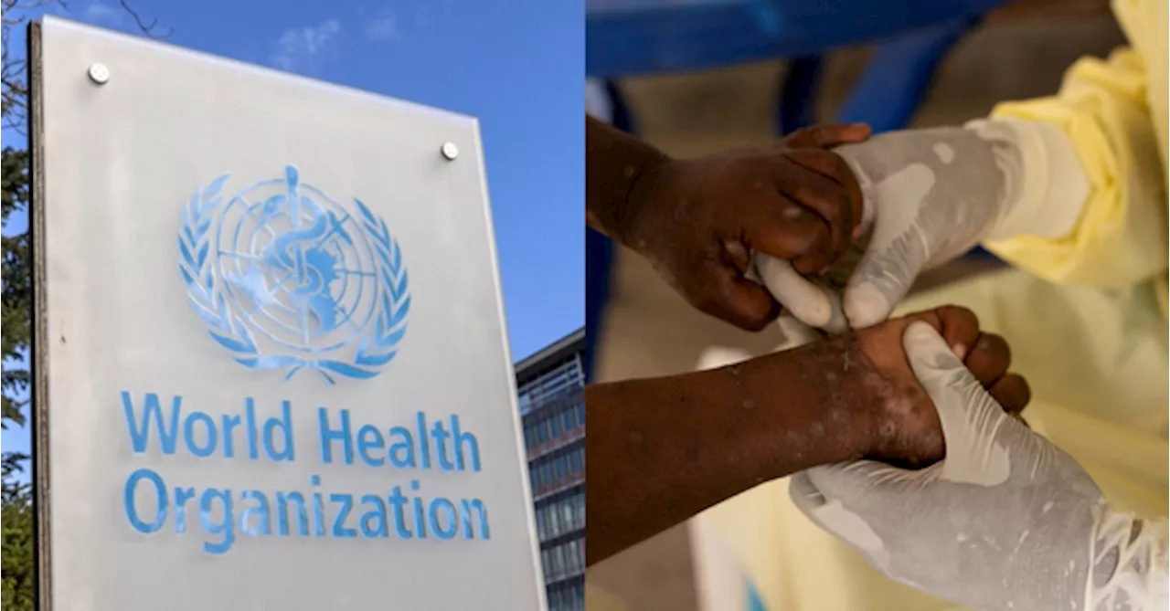 No New Mpox Cases In Malaysia As WHO Declares Global Health Emergency