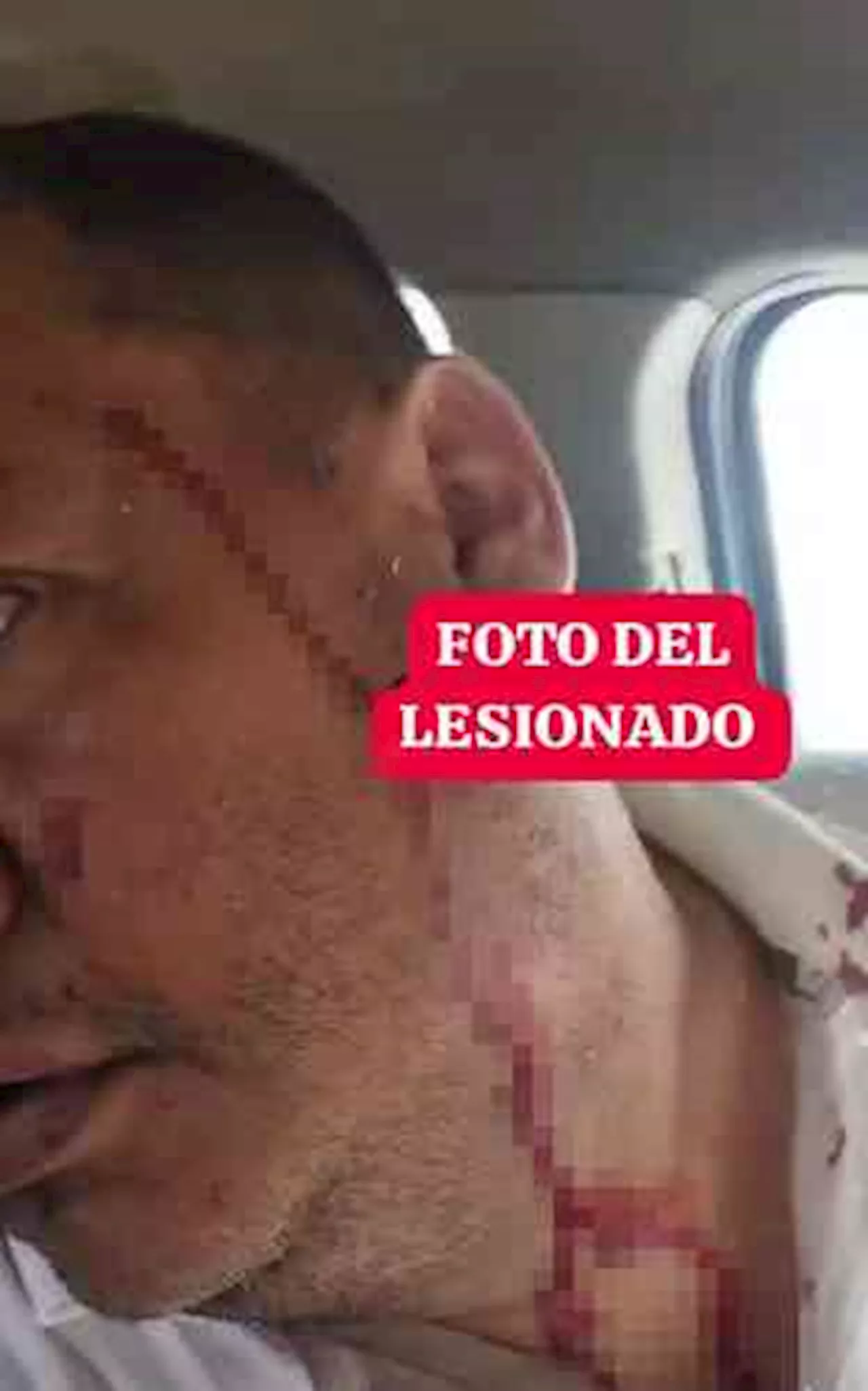 Con un machete, taxista agrede a otro ruletero, en Veracruz Puerto