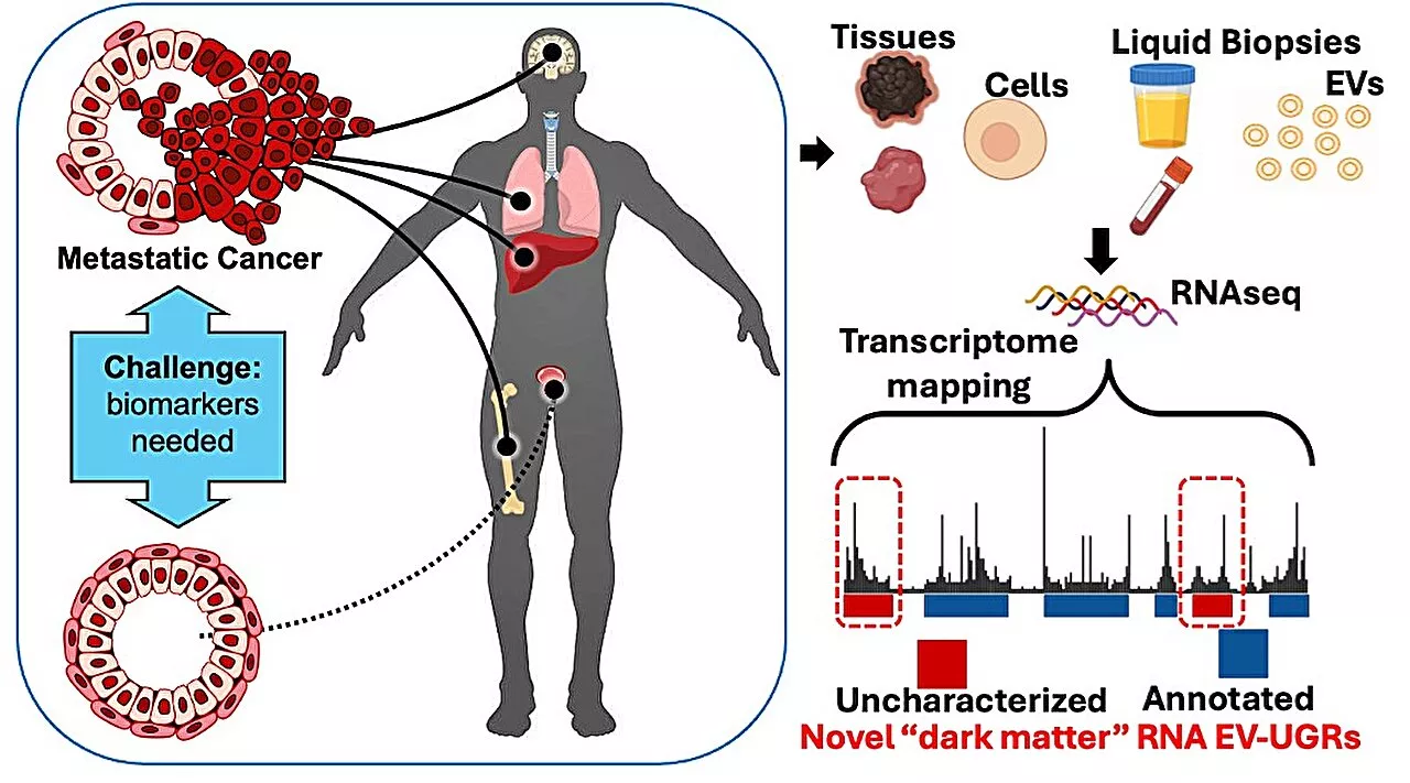 Researchers discover novel nanoparticles in blood with potential to transform cancer diagnosis