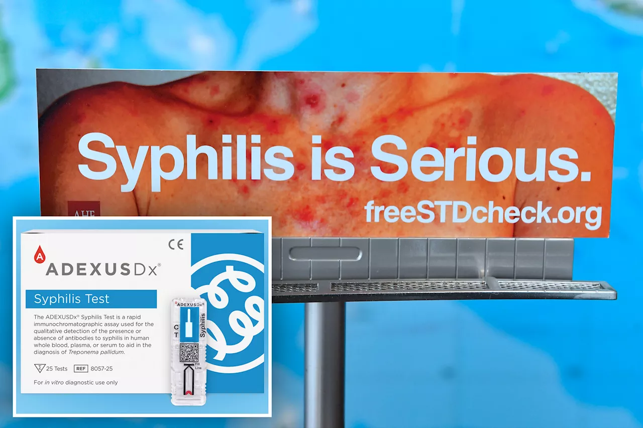 FDA approves $30 at-home syphilis test in US as cases see disturbing spike: report