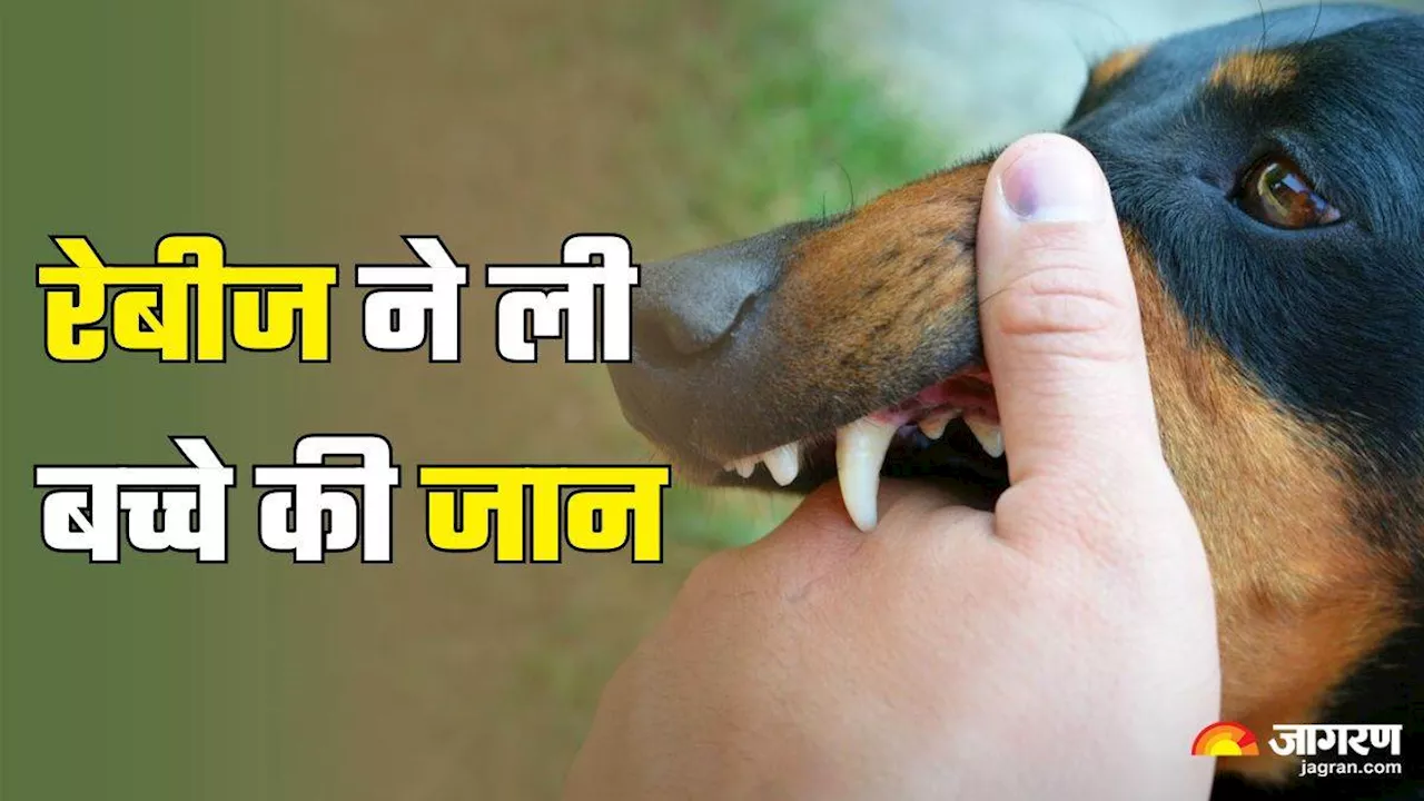 तमिलनाडू में Rabies ने ली चार साल के बच्चे की जान, डॉक्टर ने बताया कैसे करें अपना बचाव