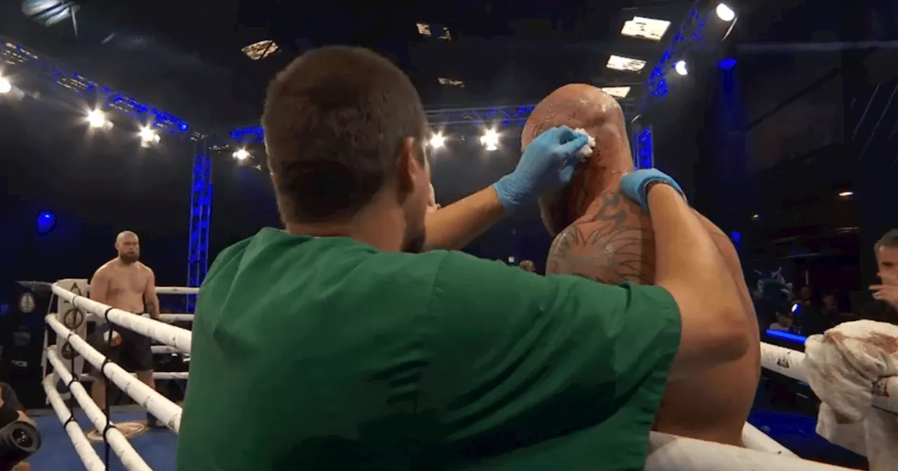 Fight stopped after Anthony Joshua's former opponent loses part of his ear