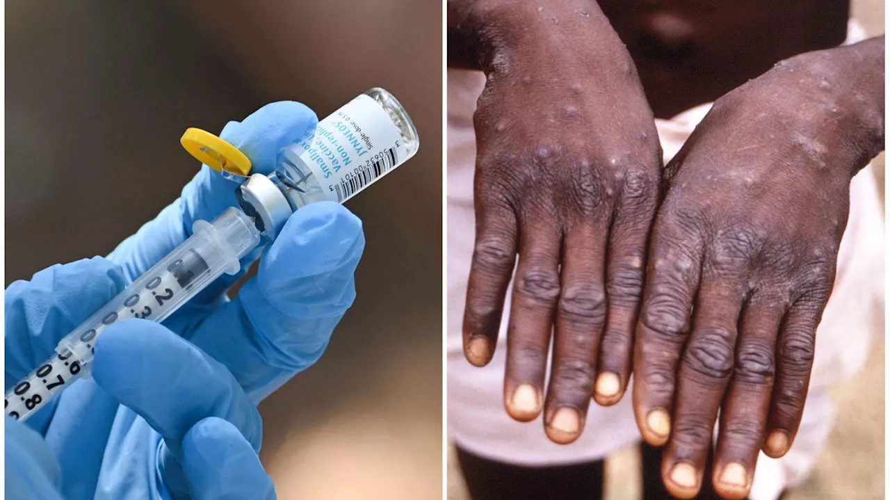 L’Afrique a besoin de davantage de vaccins contre le mpox, affirme MSF