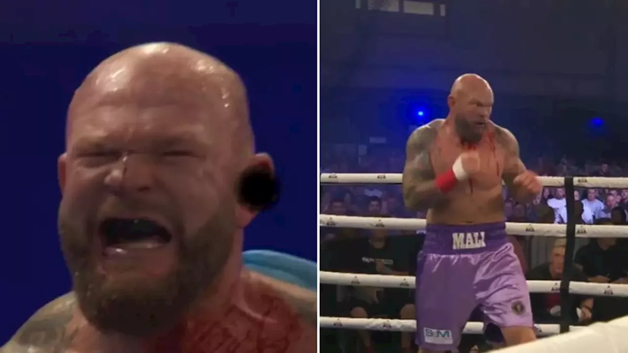 Anthony Joshua’s former opponent has ear RIPPED OFF during brutal bare-knuckle fight