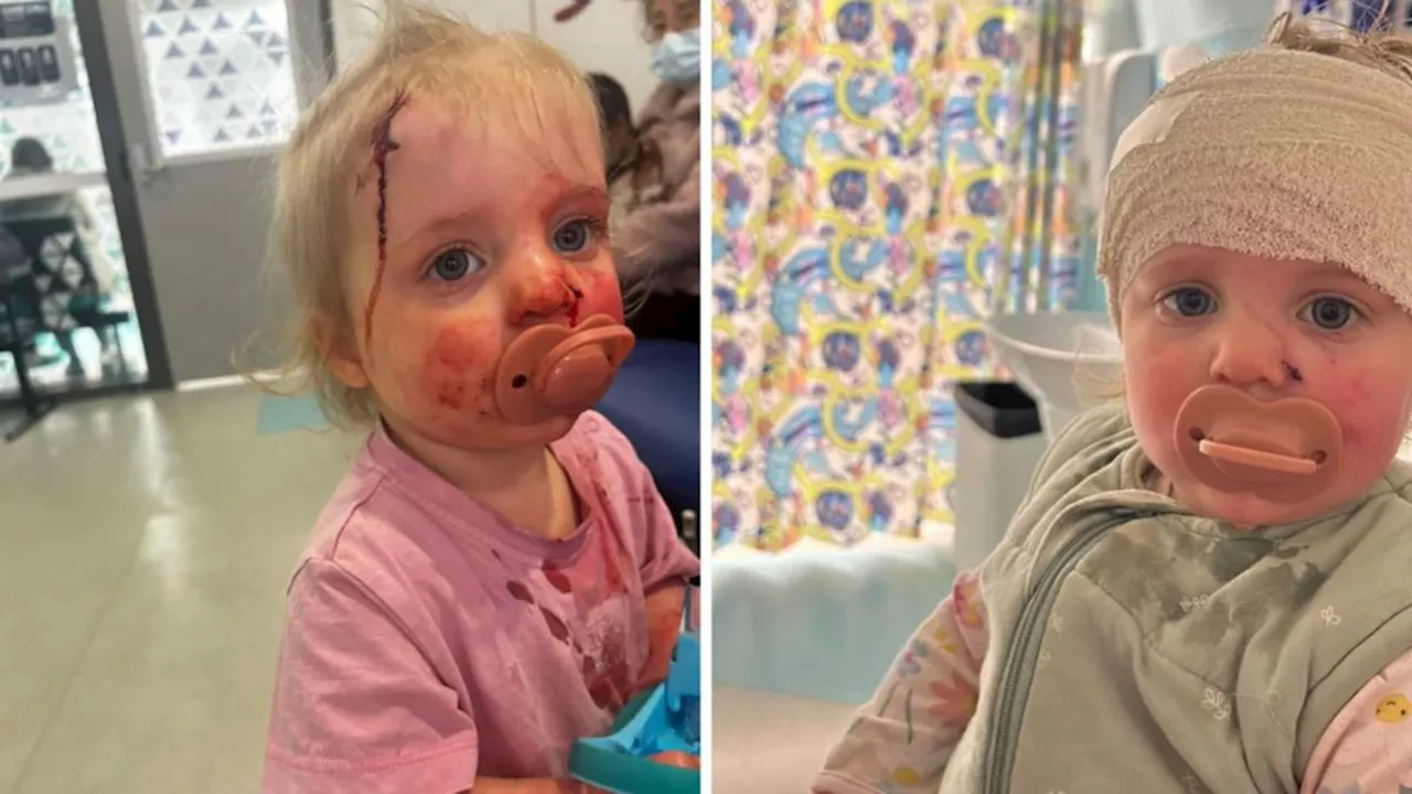 Little girl suffers facial injuries when attacked by off-leash dog in Frankston, Melbourne