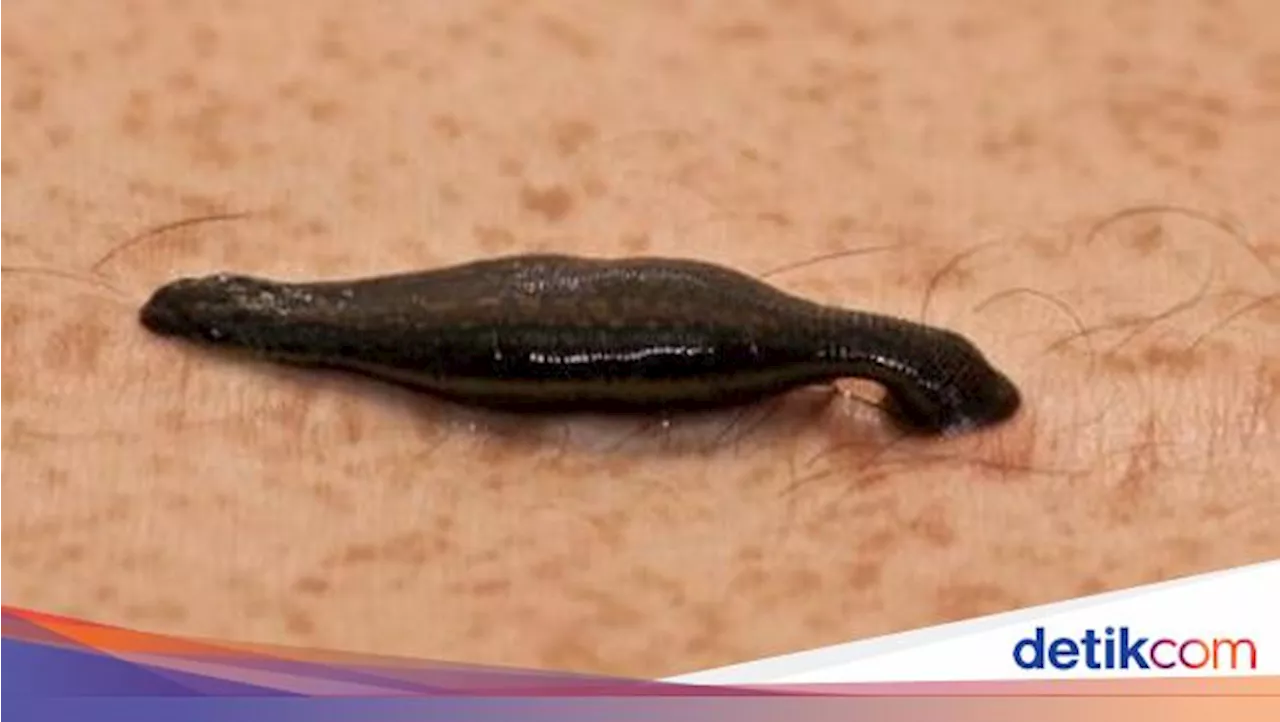 Ternyata Ini Penyebab Banyak Lintah Bermunculan di Rumah?