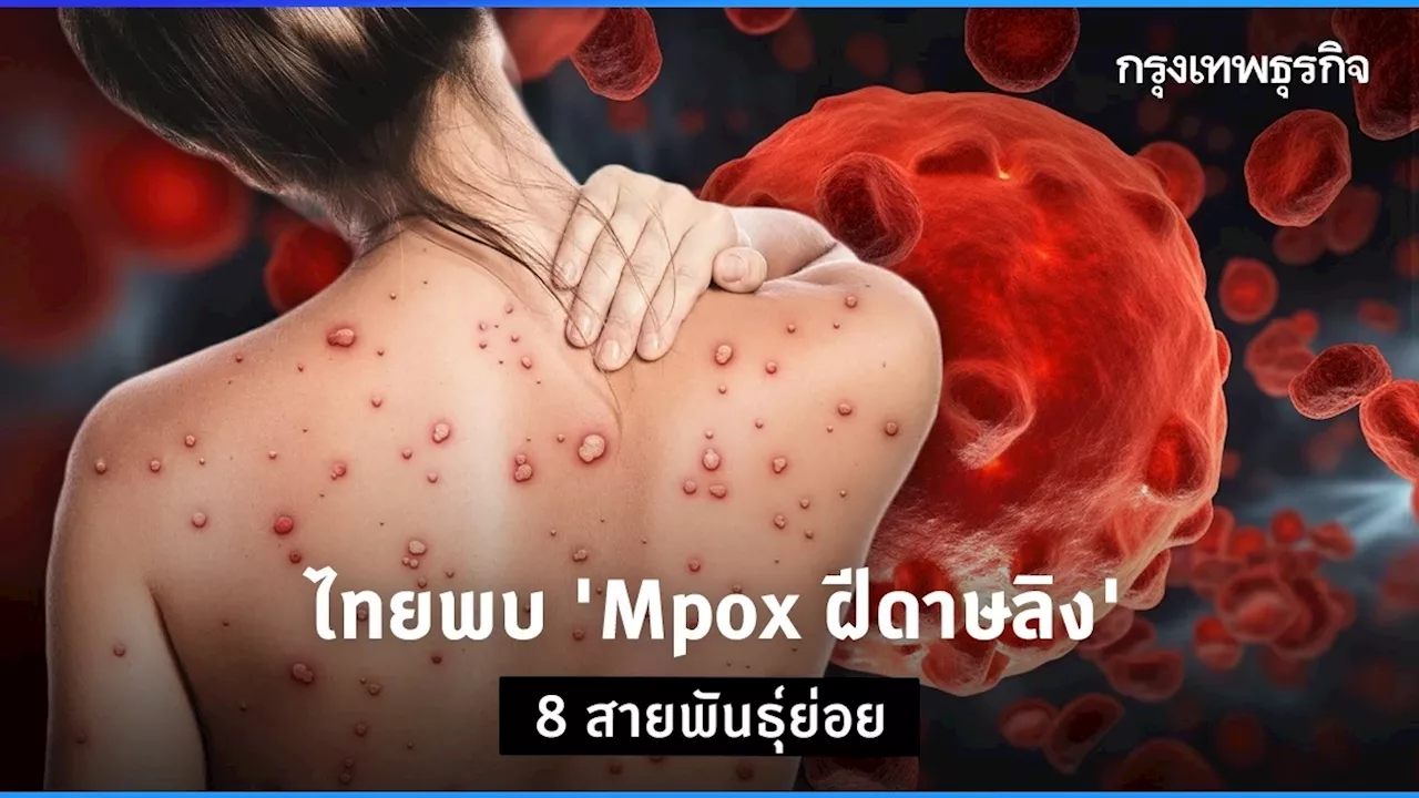 ไทยตรวจพบ 'Mpox ฝีดาษวานร' 8 สายพันธุ์ย่อย