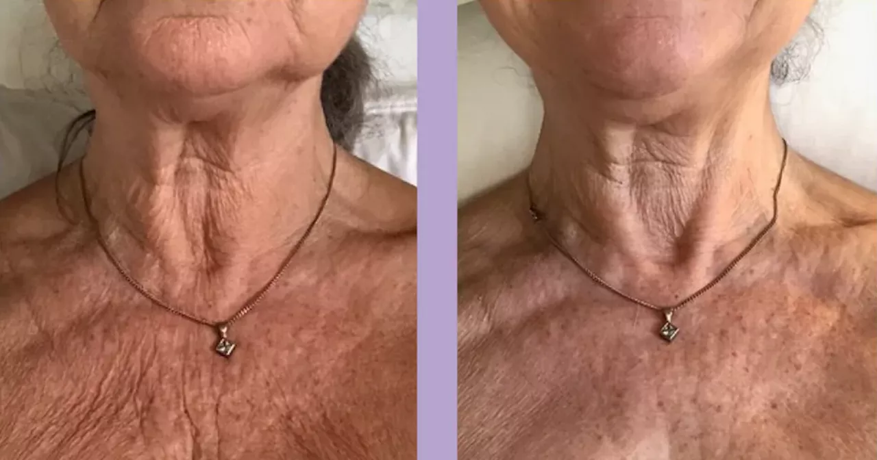  a £28 sagging skin cream keeps my décolletage looking good at my age'