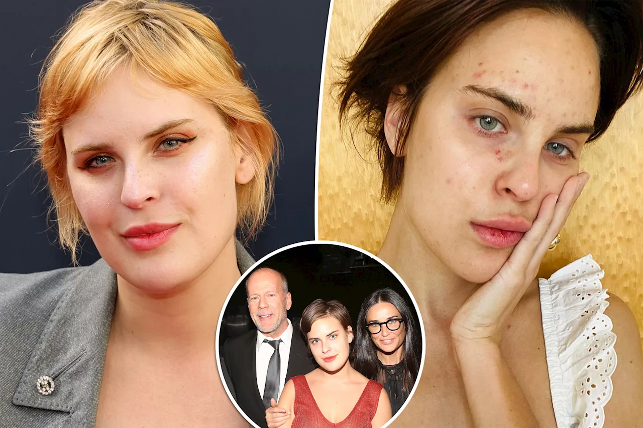 Demi Moore and Bruce Willis' daughter Tallulah shares photo of her skin picking struggle