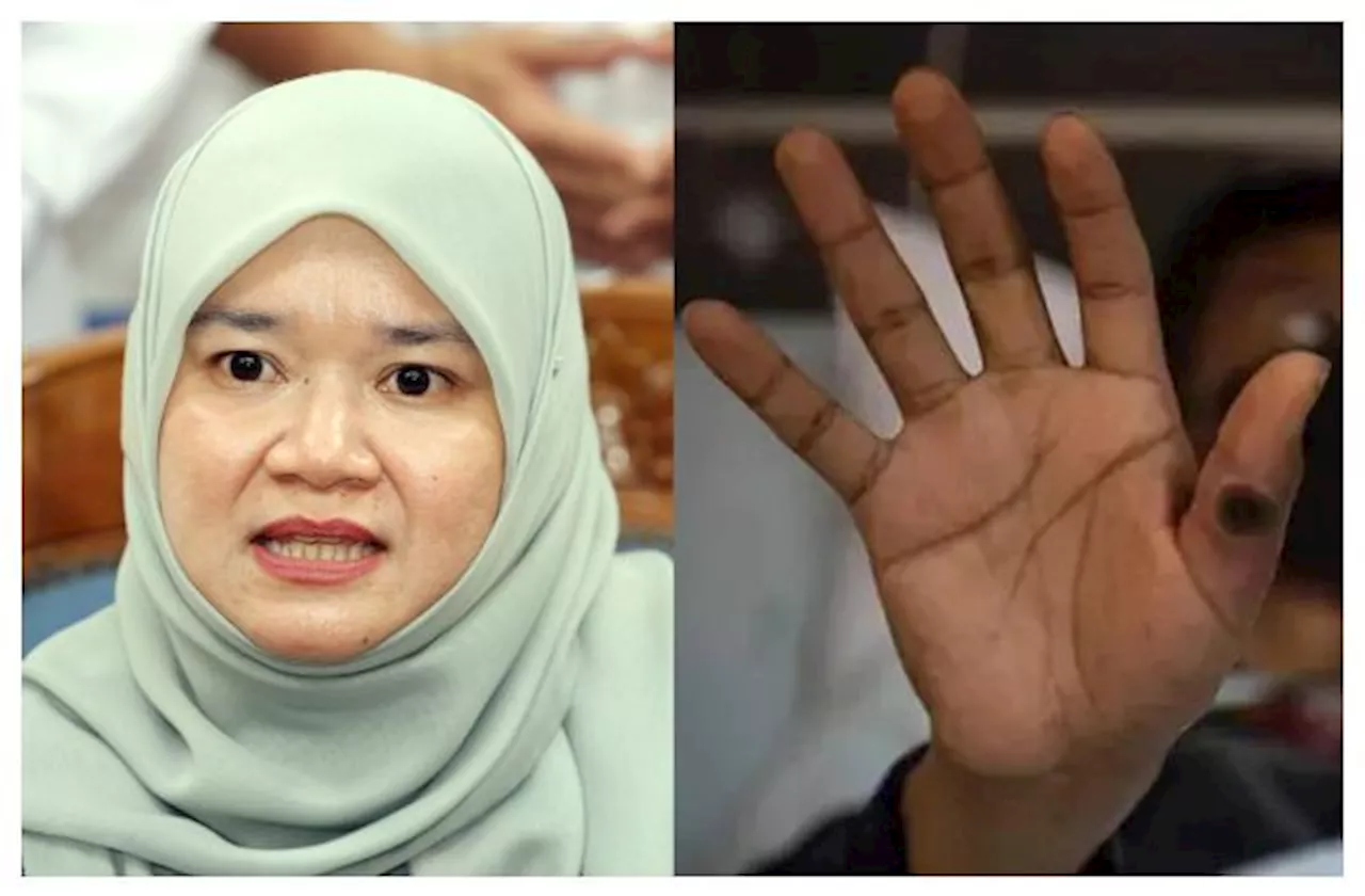 Schools’ response to mpox to heed Health Ministry’s advice, says Fadhlina