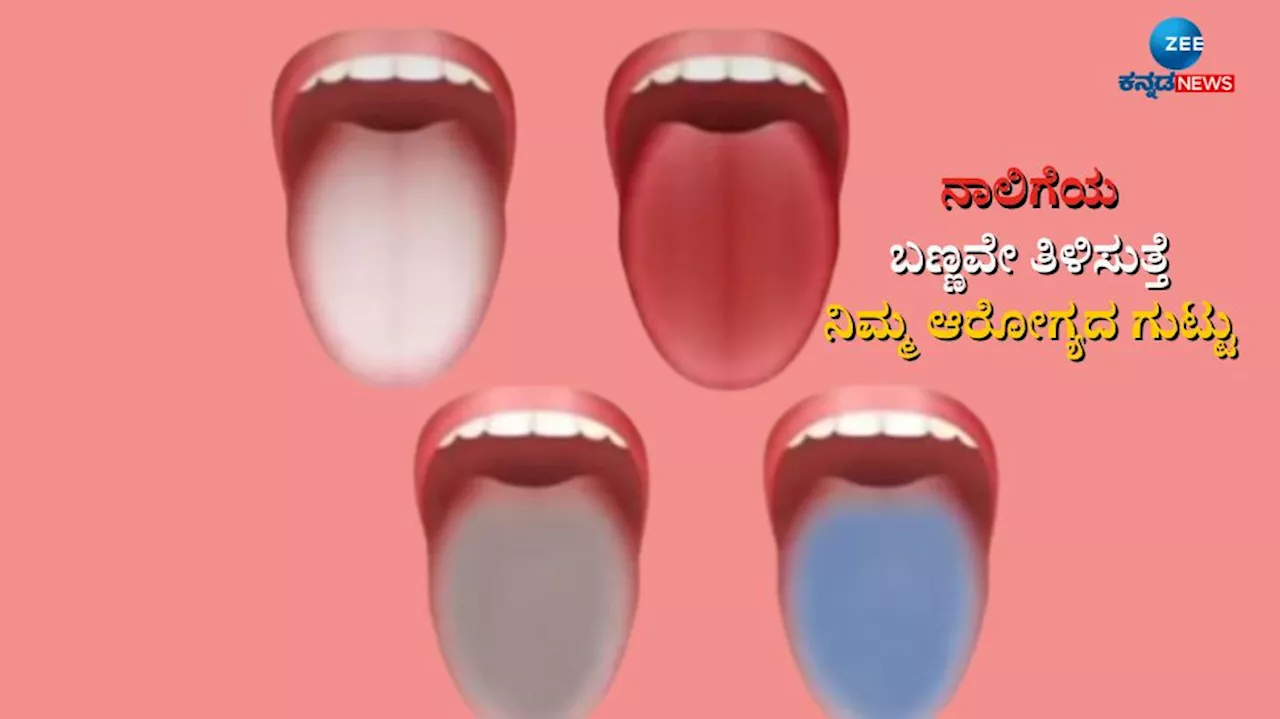 Tongue Colors: ನಾಲಿಗೆ ಬಣ್ಣ ನೋಡ್ಕೊಂಡ್ರೆ ಆರೋಗ್ಯ ಹೇಗಿದೆ ಅಂತಾ ಗೊತ್ತಾಗುತ್ತೆ? ಯಾವ ಬಣ್ಣ ಏನು ಸೂಚಿಸುತ್ತೆ ಗೊತ್ತಾ?