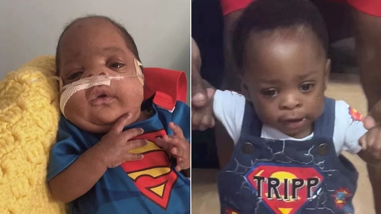 Baby born weighing less than 1 pound celebrates 1st birthday