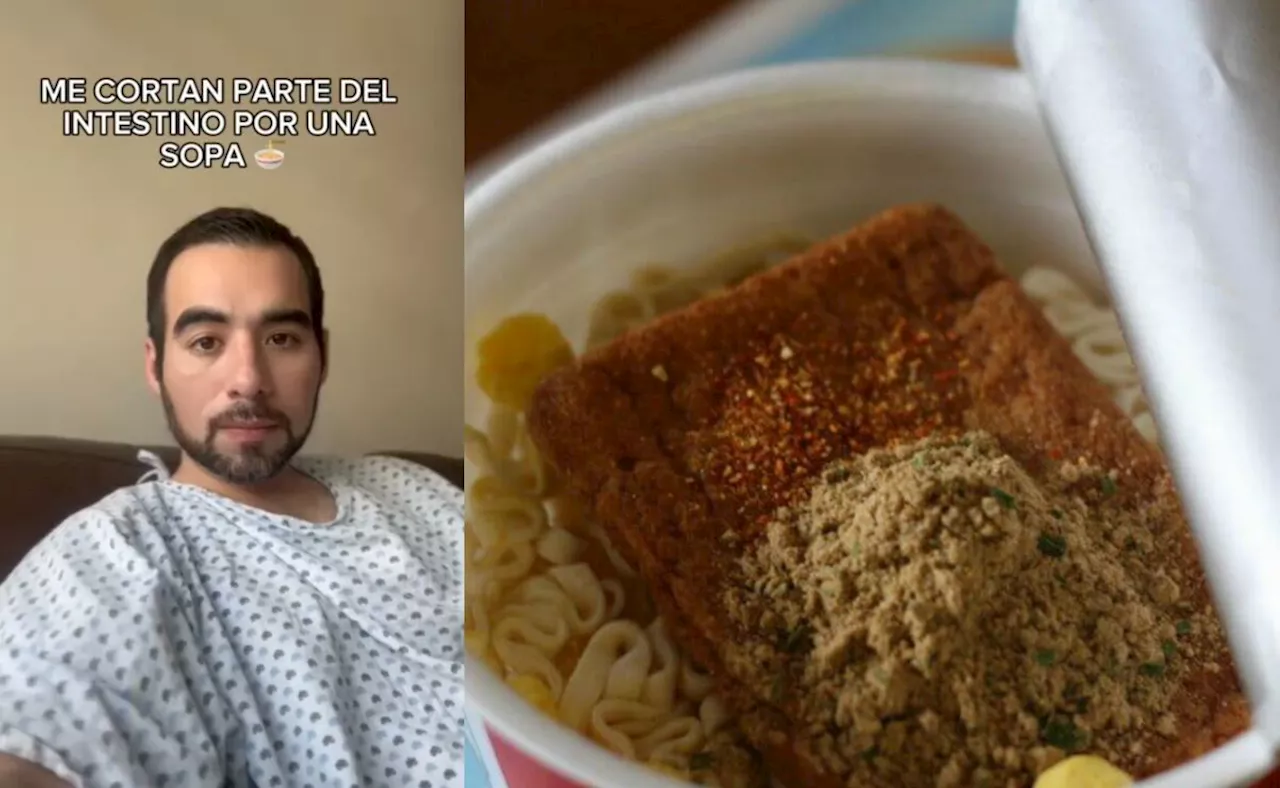 Joven termina en el hospital por problemas intestinales provocados por sopa instantánea