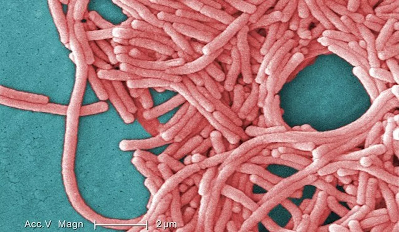 1 dead following Legionnaires’ outbreak in London, Ont.