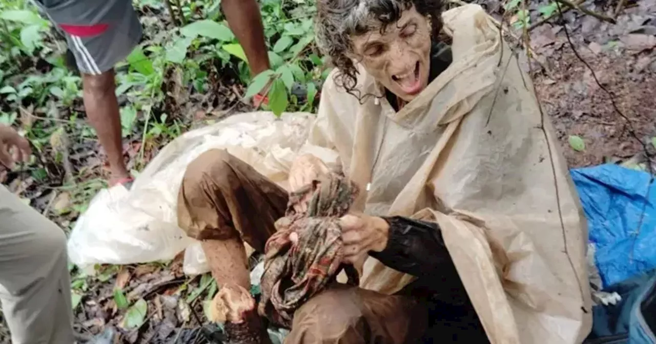 Skeletal woman found chained to tree in forest as 'husband left her for 40 days'