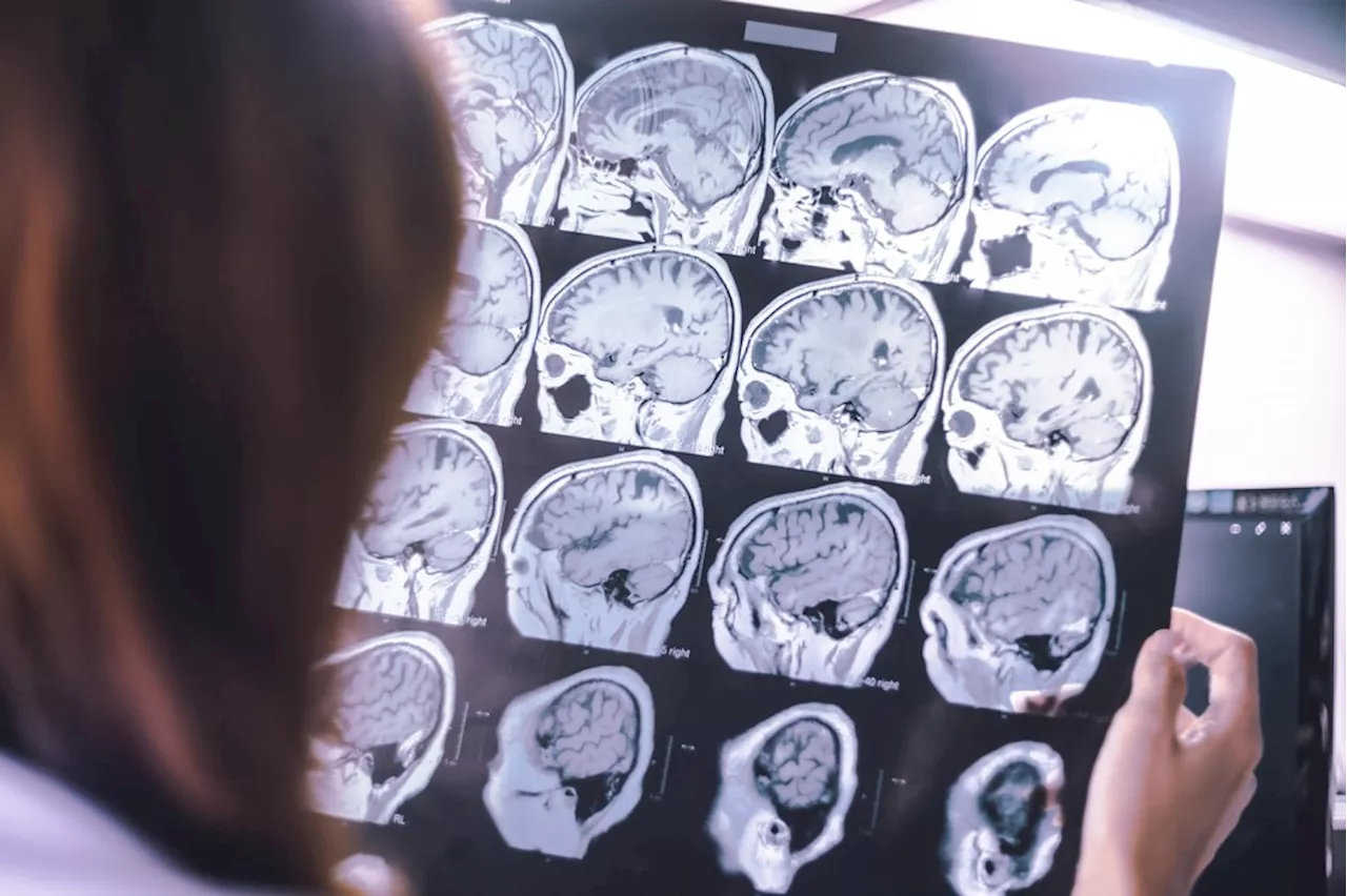 Almost half of dementia cases can be fended off, study says