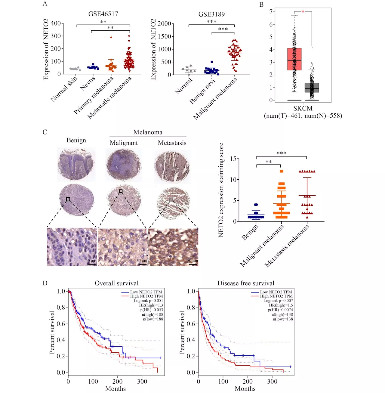 Study uncovers the role of NETO2-mediated regulation in melanoma progression