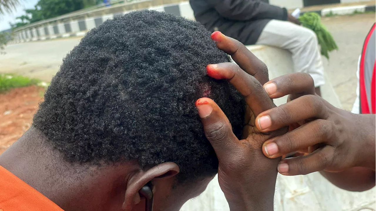 Protests: NHRC asks IGP to sanction police officers who attacked journalists, issues ultimatum