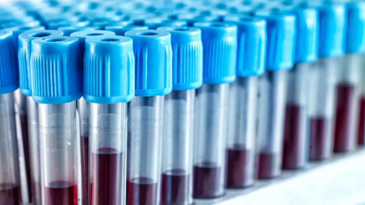 Do New Blood Tests for Cancer Meet the Right Standards?